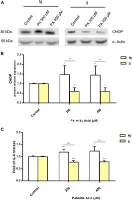 Life-Long Hyperbilirubinemia Exposure and Bilirubin Priming Prevent In Vitro Metabolic Damage